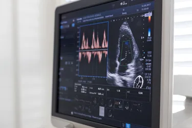 Bildschirm des Ultraschallgeräts mit farbkodierter Doppler-Darstellung des Herzens